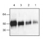 VEGF Antibody